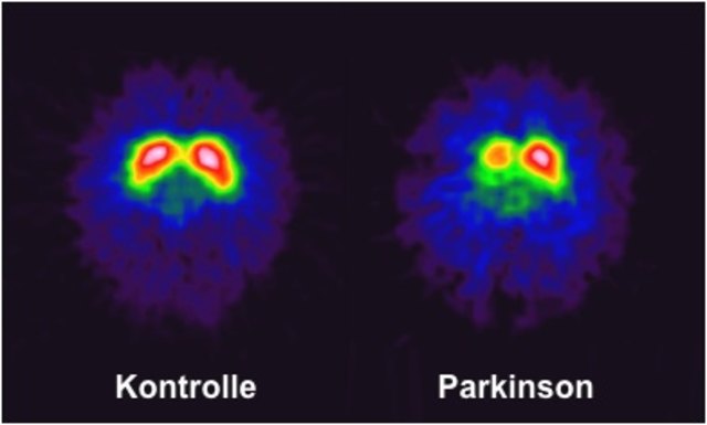 Schleichend wie das Altwerden Imst
