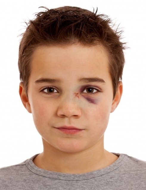 Jugendgewalt | Foto: Foto: Fotolia/Markus Bormann