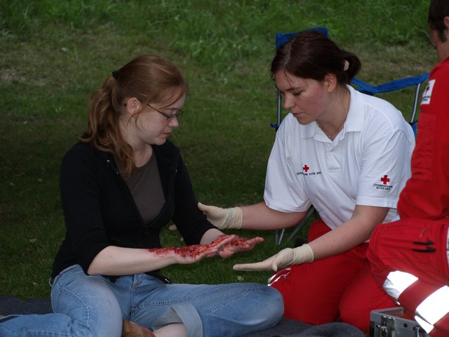Verbrennung nach Explosion beim Grillen
