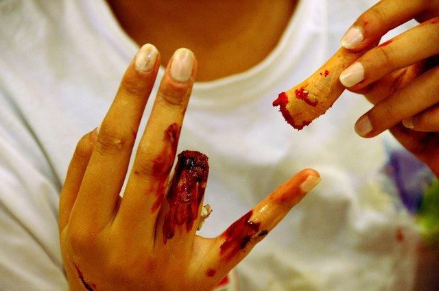 Die Rotkreuzjugendlichen müssen "Patienten" mit realistisch geschminkten Verletzungen versorgen.