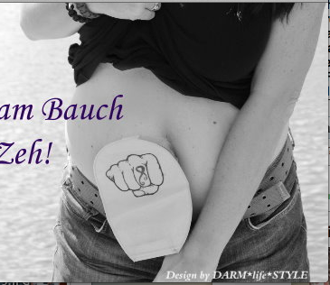 Richtige Sicht der Dinge: "Besser ein Stoma am Bauch, als einen Zettel am Zeh."