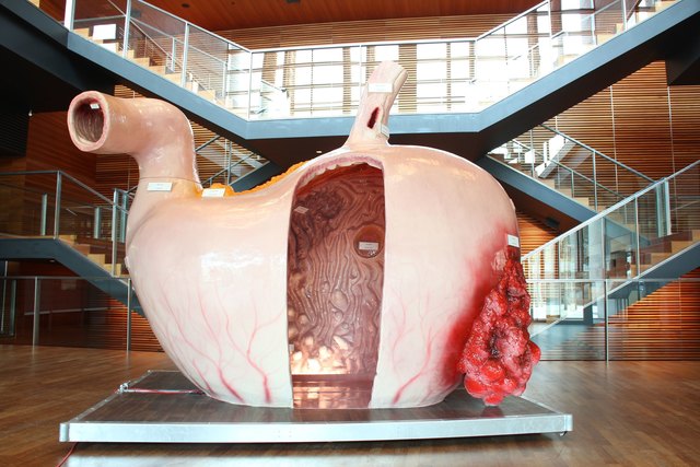 So sieht es aus, Europas größtes Magenmodell. Am 4. November ist dieses im Gesundheitszentrum-Nord "begehbar" | Foto: organmodelle.de