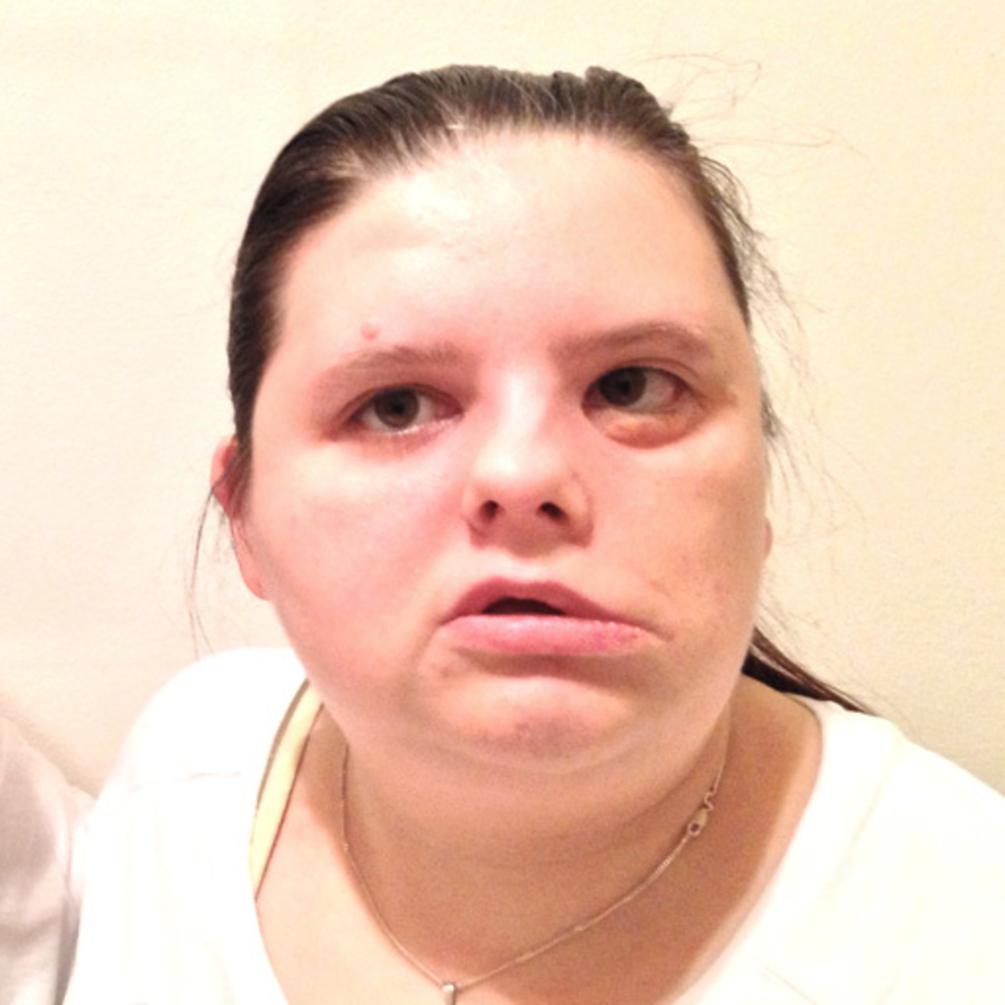 Aus Dem Herz Eine Mördergrube Machen www.meinbezirk.at