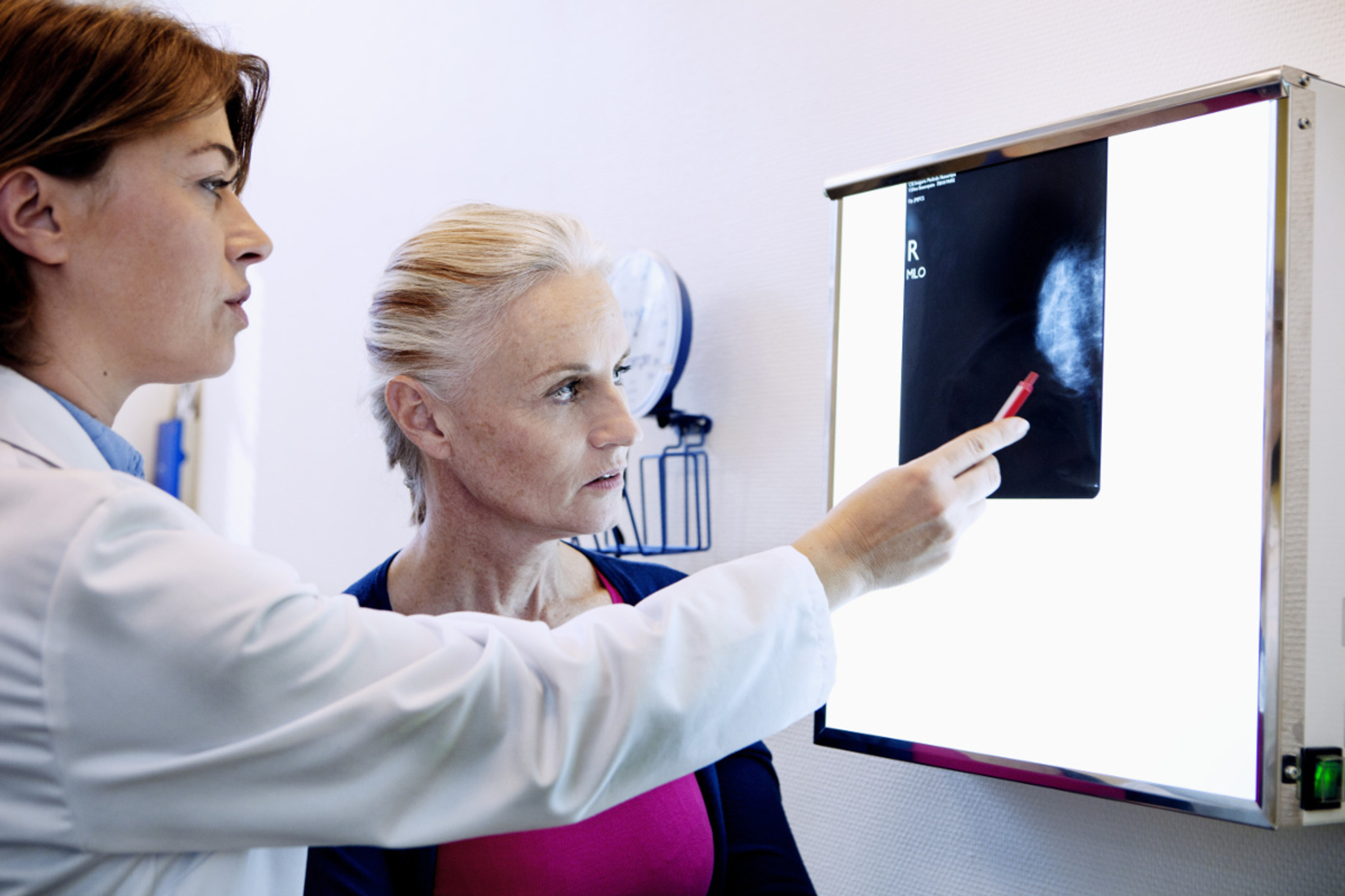 Was Passiert Wenn Die Mammographie Auffällig Ist