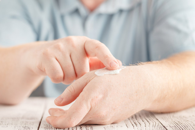 Bei Psoriasis ist die entsprechende Hautpflege nur ein Teil der Therapie.