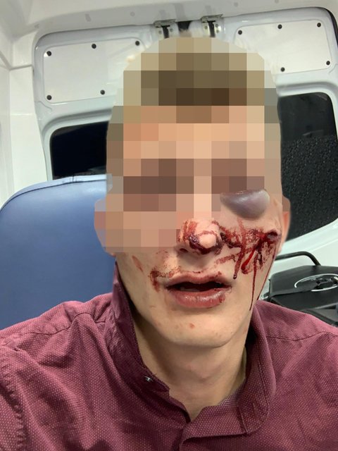 Der junge Mann wurde ordentlich verdroschen.