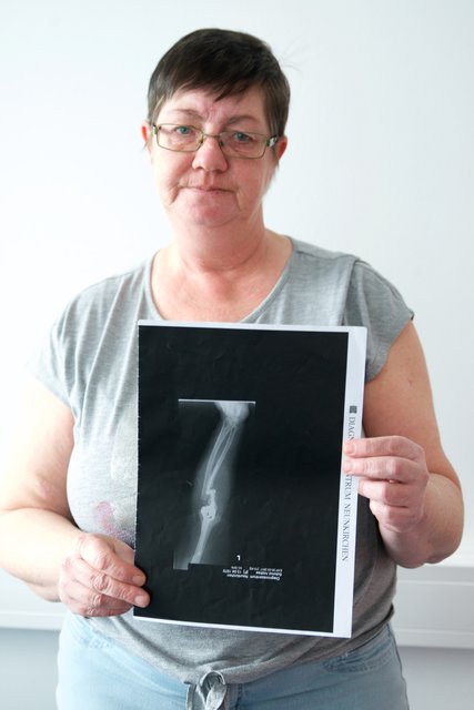 Andrea Schmid zeigt ihr Röntgenbild mit dem gebrochenem Arm. Dennoch wurde sie zum AMS geschickt.