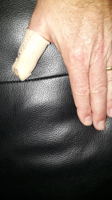 Schiene für den Daumen: der verletzte Ternitzer. | Foto: Bezirksblätter