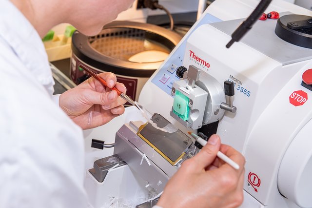Maßarbeit: Von den in Paraffinwachs eingelegten Präparaten werden drei Mikrometer dünne Scheiben zur Untersuchung abgeschnitten. | Foto: Foto Jörgler