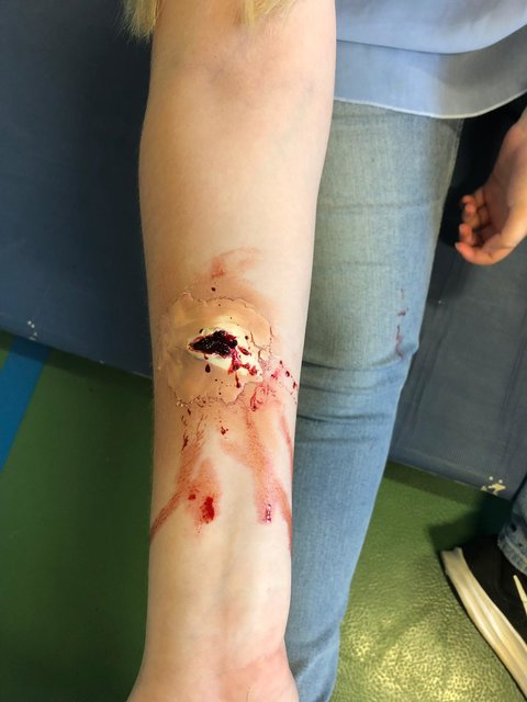 sehr realitätsnahe wurden die Wunden beim Helfi Fest geschminkt | Foto: hakzell