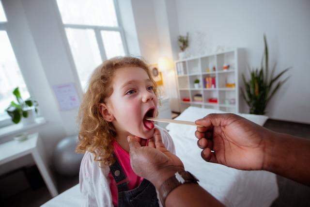 Sag Aaah! Rötungen und Schwellungen im Rachen können auf eine Halsentzündung hindeuten. | Foto: YAKOBCHUK VIACHESLAV/Shutterstock.com