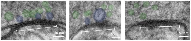 Angedockte Vesikel an einer kortikalen Synapse. Der Hirnschnitt wurde mit der "flash and freeze" Methode präpariert.