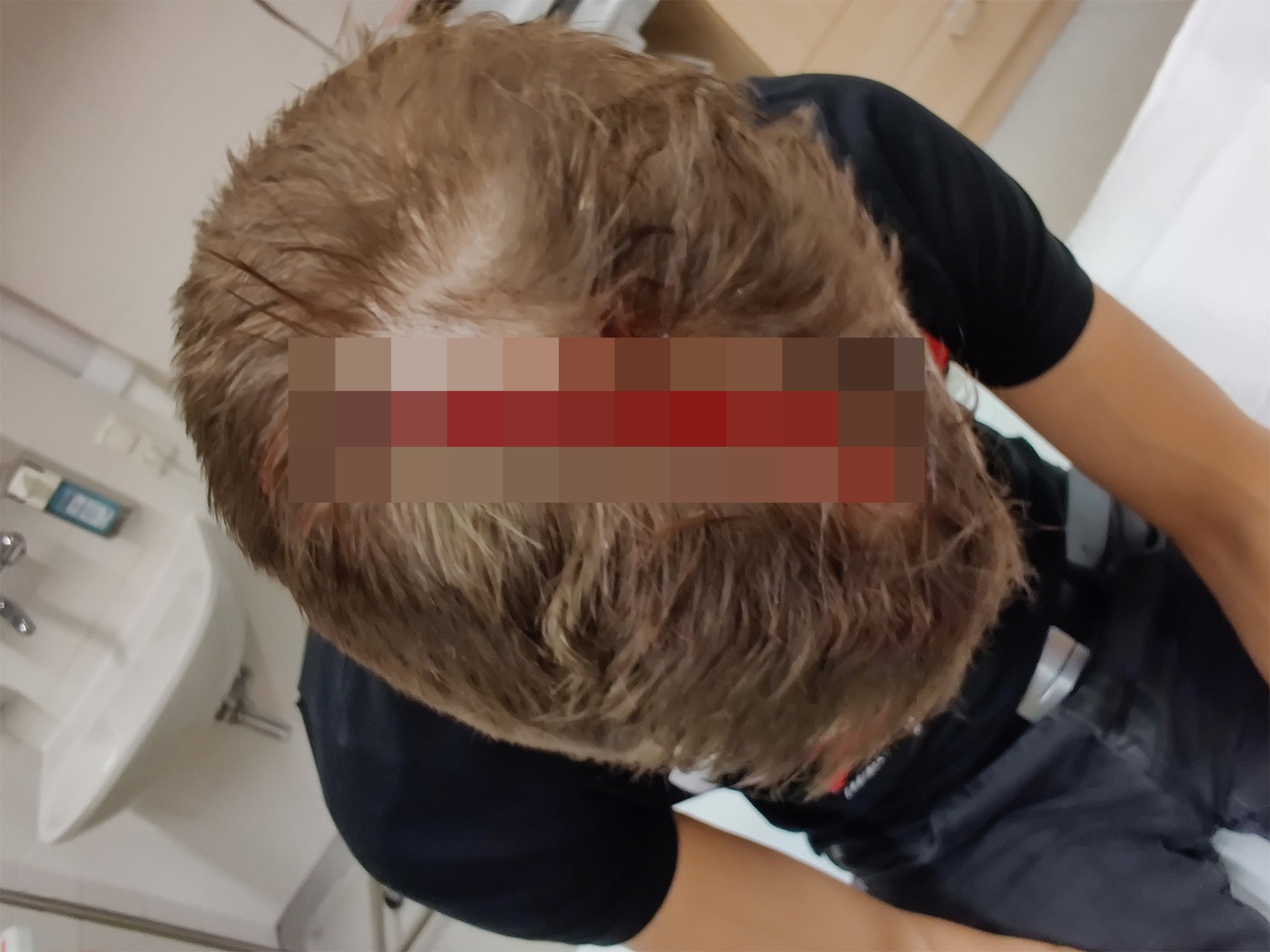 Zeugenaufruf: Schwere Kopfverletzung in Waizenkirchen zugefügt - Grieskirchen & Eferding