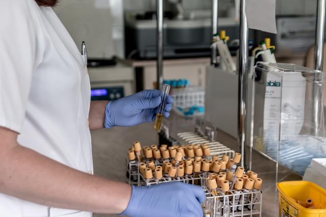Diagnostizieren lässt sich eine Ansteckung der neuen Lungenkrankheit mittels Labordiagnostik. Zu den Symptomen zählen Fieber und eine Infektion der oberen Atemwege.