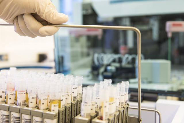 Der Bezirk Landeck steht besonders im Fokus der Corona-Virus-Epidemie. Im regionalen Krankenhaus St. Vinzenz in Zams müssen die Verantwortlichen ebenfalls damit umgehen, dass Ansteckungen mit Covid-19 nicht vor dem medizinischen Personal haltmachen.