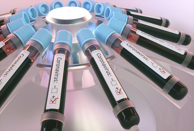 Aktuell sind sechs Personen aus dem Umfeld der "Freien Christengemeinde – Pfingskirche" mit dem Corona-Virus infiziert. Aus Sicherheitsgründen wurden 30 Personen abgesondert.