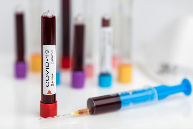 Eine positiv auf das Corona-Virus getestete Linzerin war in der Vorwoche gleich viermal auf der Zugstrecke Linz – Wien unterwegs.