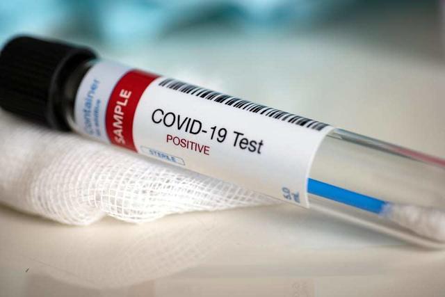 Die Zahl an positiven Coronavirus-Testungen ist in der Landeshauptstadt auf 28 angestiegen.
