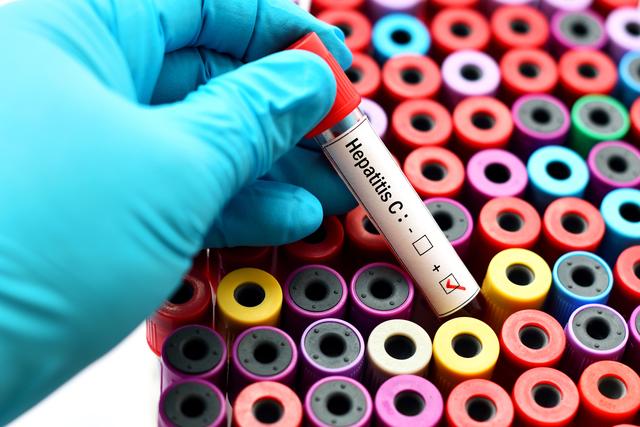 Laut Weltgesundheitsorganisation WHO sind weltweit rund 71 Millionen Menschen von der chronischen Verlaufsform betroffen. Jährlich führt Hepatitis C bei geschätzten 400.000 Menschen zum Tod.