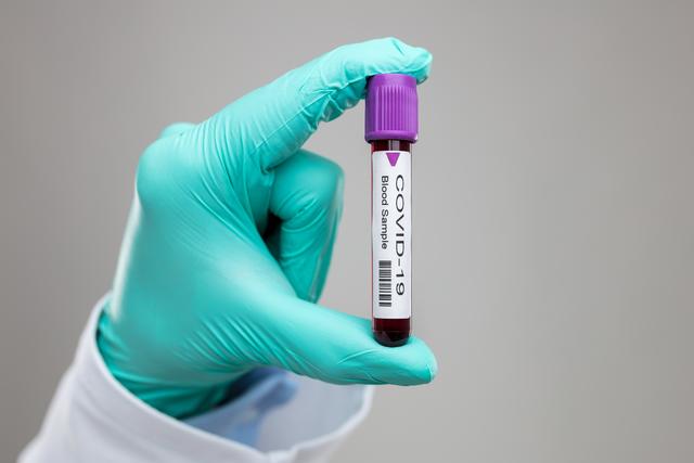 Im Burgenland ist aktuell 435 Personen mit dem Coronavirus infiziert.
