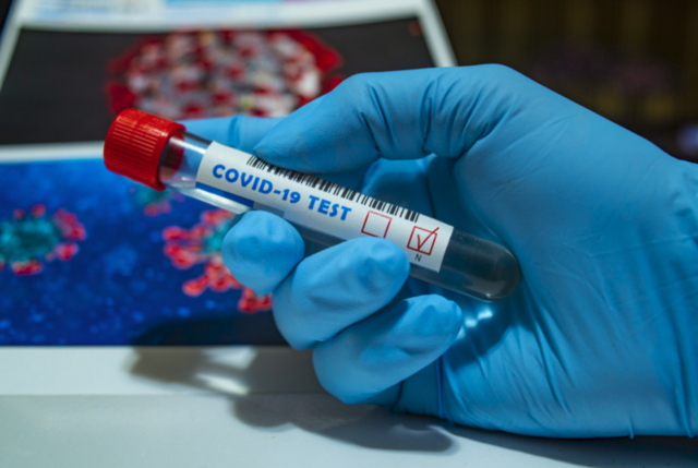 In Wiener Neudorf wurde die Südafrika-Mutation des Coronavirus nachgewiesen. | Foto: RMA Archiv/pixabay