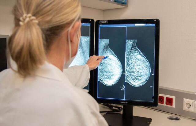 Kontrolle ist besser: Bei der 3-D-Mammografie gibt es Schicht für Schicht ein hoch präzises Ergebnis.