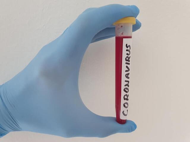 Am Dienstag wurden in Österreich 582 Neuinfektionen und 19 Todesfälle in Verbindung mit dem Coronavirus gemeldet.