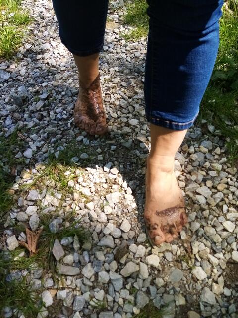 Der Split ist schmerzhaft und vorsichtiges Gehen ist angesagt