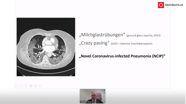 Die glasig eingetrübten Bereiche der Lunge sind entzündete Bereiche, die die Funktion des Organs massiv einschränken. | Foto: Screenshot Vortrag Dr. Bernd Lamprecht