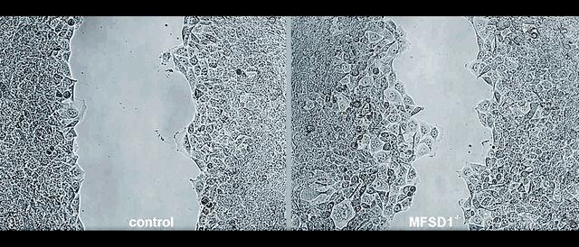 Unterdrückung der Metastasierung. Hohe Konzentrationen des Proteins MFSD1 in Krebszellen erschweren es diesen, in andere Teile des Körpers zu wandern.  | Foto:  ISTA/Marko Roblek