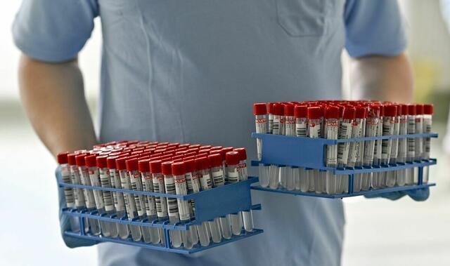 Welche Virusmutation kommt nach Omikron? Forscher:innen aus Graz gehen in Kooperation mit mit dem medizinischen Labor infektiologie.tirol genau dieser Frage nach. | Foto: HERBERT NEUBAUER / APA / picturedesk.com