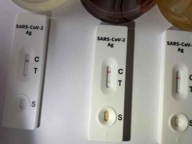 Corona-Test (Symbolfoto). | Foto: Martin Schöndorfer, 2022
