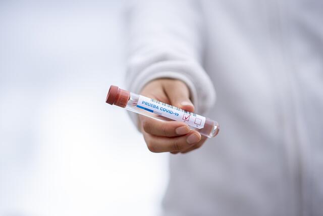 In der Schweiz und in Spanien wurde die Quarantäne für alle – auch für positiv getestete Personen abgeschafft. In Österreich wurden die Quarantäneregeln gelockert. In unserer Umfrage der Woche zur Aufhebung de Quarantäne ist die Meinung gespalten | Foto: pixabay/fernandozhiminaicela