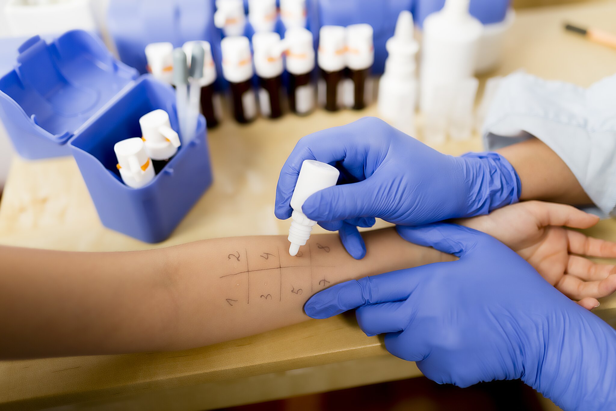 Neue-Plattform-f-r-Allergikerinnen-und-Allergiker