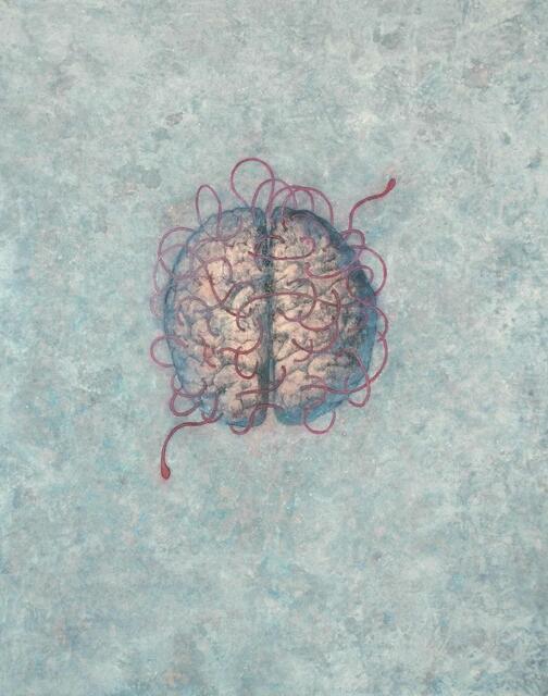 Gehirnbild "Penetratio" von Markus Waltenberger. | Foto: Waltenberger