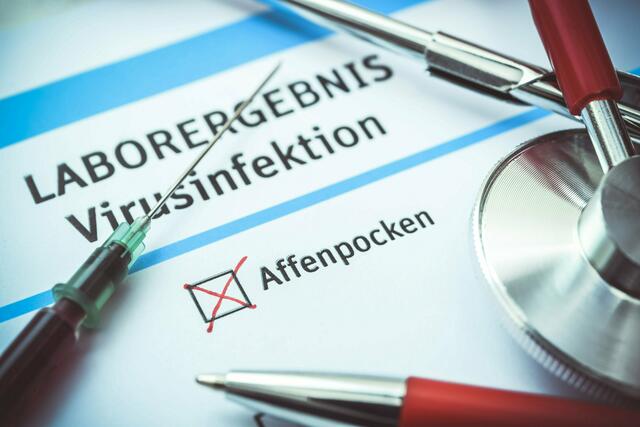 Prinzipiell gilt die Quarantäne bei Affenpocken für drei Wochen. Heilen die Pocken schneller ab, wird die Quarantäne nach ärztlicher Bestätigung früher aufgehoben. | Foto: Michael Bihlmayer / ChromOrange / picturedesk.com