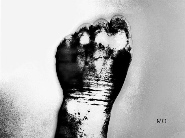 Weltfrauentag, Gewalt an Frauen, sexuelle Übergriffe