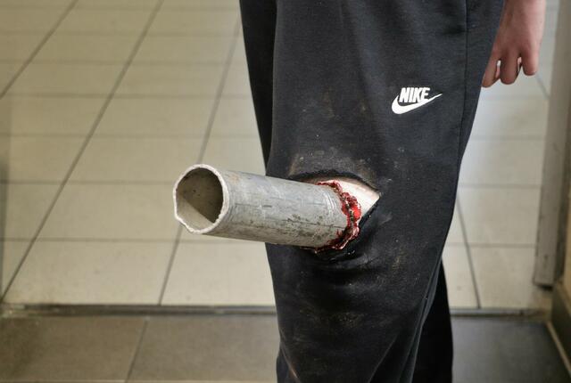 Nikis Rohr im Bein. | Foto: Christian Nowotny