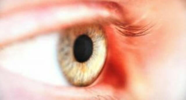 Sehbehinderungen betreffen einen immer größer werdenden Teil der Bevölkerung. | Foto: Auge © BSVK