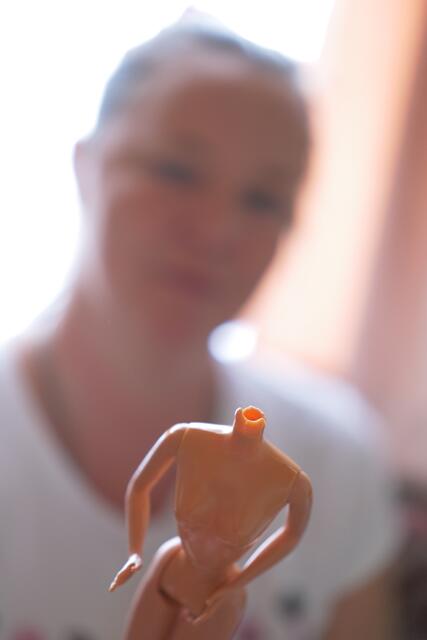 Alptraum für Sammler: ein Halsbruch bei einer älteren Barbie.