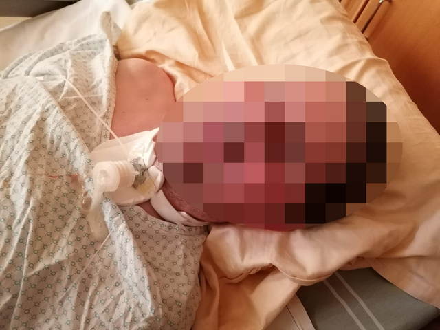 Franz und die Kanüle am Hals. | Foto: privat