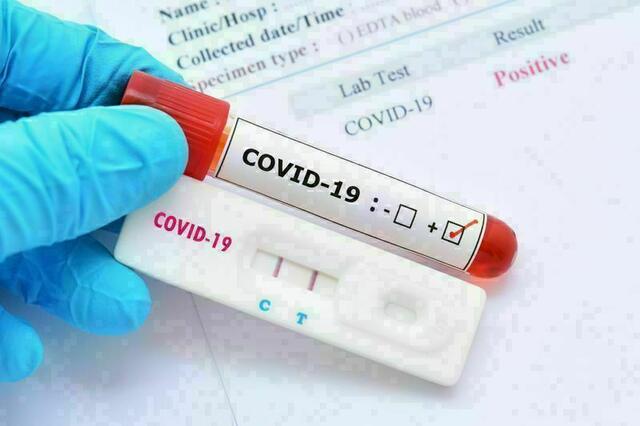 Die Kosten für den recht zuverlässigen Schnelltest auf Covid-19 in ärztlichen Praxen werden zwar derzeit übernommen, aber diese Unterstützung gilt nur bis zum 31. März. | Foto: MeinBezirk.at