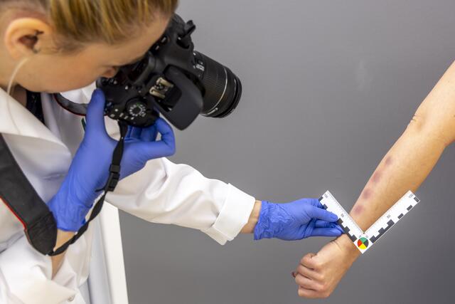 In der Gewaltambulanz werden Verletzungen auch dokumentiert. | Foto: Med Uni Graz/Lunghammer