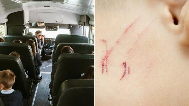 Einem Kind mit hoher Pflegestufe wurde von den Fahrern der Transporte kein Verständnis entgegengebracht. Das Kind wurde von anderen Kindern drangsaliert und nicht richtig gesichert. Für ein Rettungsunternehmen wäre das Kind "zu wenig behindert". | Foto: RMA Tirol