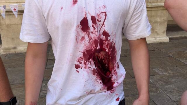 "Fake-Wunden" eines Schauspielers | Foto: Julia Glajncer