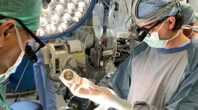 Johannes Holfeld (r) hält das Stoßwellengerät während einer Bypass-Operation in der Hand. | Foto: Univ.-Klinik f. Herzchirurgie/MUI