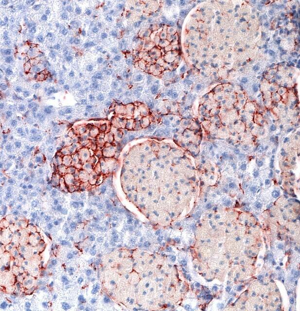 „Diese neuen Erkenntnisse bieten Hoffnung auf eine zusätzliche, verbesserte Behandlungsmöglichkeit für Patientinnen und Patienten mit LAL-Mangel und könnten einen wichtigen Schritt in der medizinischen Forschung darstellen“, so Dagmar Kratky. | Foto: Med Uni Graz