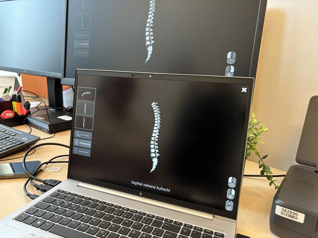 Die Ergebnisse der Wirbelsäulendiagnostik kann man sich in 3D ansehen.  | Foto: Kriechbaum/MeinBezirk