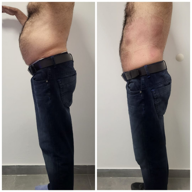 Auch für Männer. | Foto: Abnehmen im Liegen GmbH