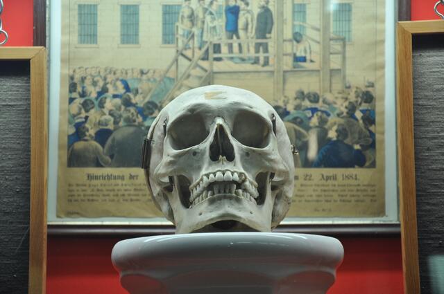 Der Schädel des Mädchenmörders Hugo Schenk. | Foto: Wiener Kriminalmuseum